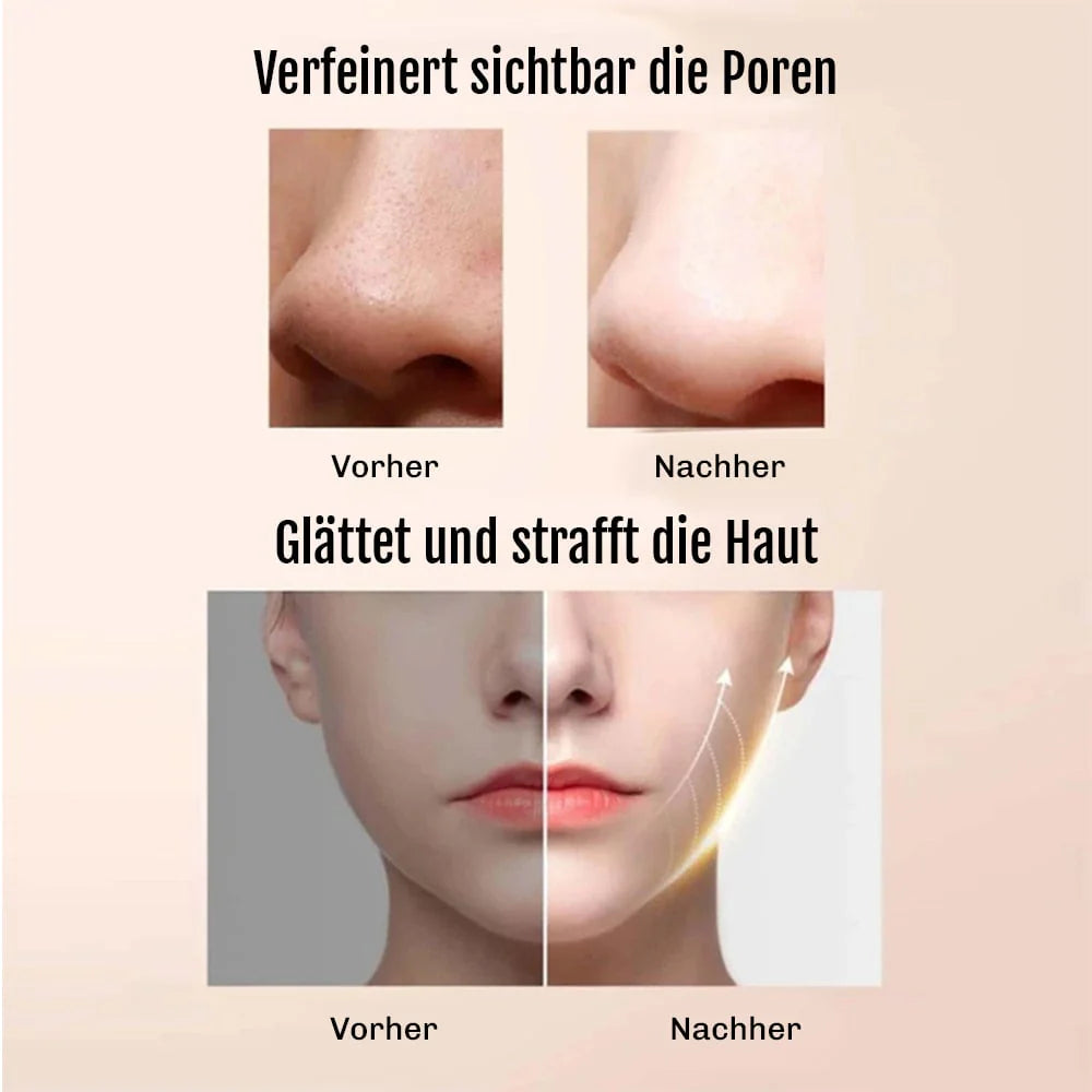 Ultraschall Peeling Gerät DermaGlow 5