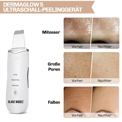Ultraschall Peeling Gerät DermaGlow 5